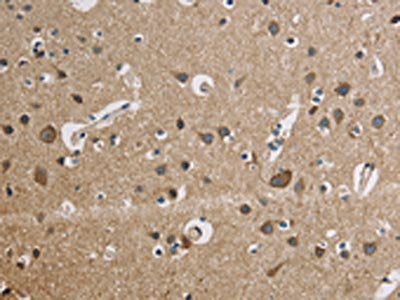 The image is immunohistochemistry of paraffin-embedded Human brain tissue using the antibody Antibody) at dilution 1/50. (Original magnification: ×200)Rabbit anti-Human CYCS Polyclonal Antibody