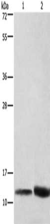 Gel: 8%SDS-PAGE, Lysate: 40 μg, Lane 1-2: Hela cells, mouse brain tissue, Primary antibody: CYCS Antibody(CYCS Antibody) at dilution 1/600, Secondary antibody: Goat anti rabbit IgG at 1/8000 dilution, Exposure time: 10 secondsRabbit anti-Human CYCS Polyclonal Antibody