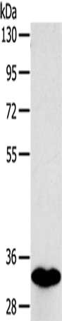 Gel: 8%SDS-PAGE, Lysate: 40 μg, Lane: Human fetal intestines tissue, Primary antibody: SULT1B1 Antibody(SULT1B1 Antibody) at dilution 1/800, Secondary antibody: Goat anti rabbit IgG at 1/8000 dilution, Exposure time: 3 secondsRabbit anti-Human SULT1B1 Polyclonal Antibody