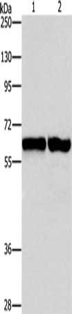 Gel: 15%SDS-PAGE, Lysate: 40 μg, Lane 1-2: 231 cells, NIH/3T3 cells, Primary antibody: ASNS Antibody(ASNS Antibody) at dilution 1/800, Secondary antibody: Goat anti rabbit IgG at 1/8000 dilution, Exposure time: 1 minuteRabbit anti-Human ASNS Polyclonal Antibody