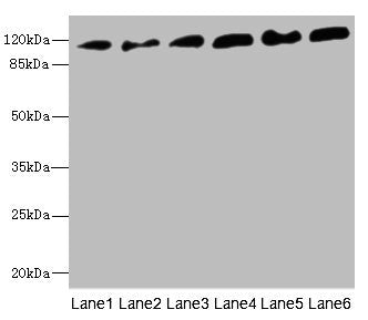 Western blot | All lanes: PCDH1 antibody at 2.56μg/ml | Lane 1: A431 whole cell lysate | Lane 2: Human breast cancer cell | Lane 3: Jurkat whole cell lysate | Lane 4: Hela whole cell lysate | Lane 5: NIH/3T3 whole cell lysate | Lane 6: 293T whole cell lysate | Secondary | Goat polyclonal to rabbit IgG at 1/10000 dilution | Predicted band size: 115, 134 kDa | Observed band size: 115 kDaRabbit anti-Human PCDH1 Polyclonal Antibody