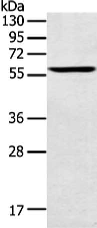 Gel: 8%SDS-PAGE, Lysate: 40 μg, Lane: Human lung cancer tissue, Primary antibody: SPATA6 Antibody(SPATA6 Antibody) at dilution 1/200 dilution, Secondary antibody: Goat anti rabbit IgG at 1/8000 dilution, Exposure time: 10 secondsRabbit anti-Human SPATA6 Polyclonal Antibody