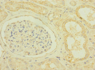 Immunohistochemistry of paraffin-embedded human kidney tissue using SCN7A Antibody at dilution of 1:100