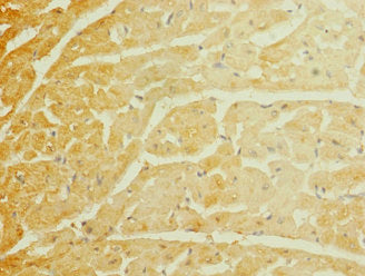 Immunohistochemistry of paraffin-embedded human heart tissue using SCN7A Antibody at dilution of 1:100