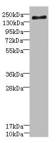 Western blot  | All lanes: SCN7A antibody at 2.36µg/ml + Jurkat whole cell lysate  | Secondary  | Goat polyclonal to rabbit IgG at 1/10000 dilution  | Predicted band size: 194 kDa  | Observed band size: 194 kDa