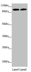 Western blot  | All lanes: PDE6A antibody at 3.33µg/ml  | Lane 1: Mouse eye tissue  | Lane 2: A549 whole cell lysate  | Secondary  | Goat polyclonal to rabbit IgG at 1/10000 dilution  | Predicted band size: 100 kDa  | Observed band size: 100 kDaRabbit anti-Human PDE6A Polyclonal Antibody