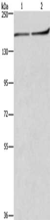 Gel: 6%SDS-PAGE, Lysate: 40 μg, Lane 1-2: Raji cells, NIH/3T3 cells, Primary antibody: HDLBP Antibody(HDLBP Antibody) at dilution 1/250, Secondary antibody: Goat anti rabbit IgG at 1/8000 dilution, Exposure time: 2 minutesRabbit anti-Human HDLBP Polyclonal Antibody