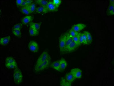 Immunofluorescence staining of HepG2 cells with ROR2 Antibody at 1:100, counter-stained with DAPI. The cells were fixed in 4% formaldehyde, permeabilized using 0.2% Triton X-100 and blocked in 10% normal Goat Serum. The cells were then incubated with the antibody overnight at 4°C. The secondary antibody was Alexa Fluor 488-congugated AffiniPure Goat Anti-Rabbit IgG(H+L).Rabbit anti-Human ROR2 Polyclonal Antibody