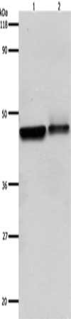 Gel: 10%SDS-PAGE, Lysate: 30 μg, Lane 1-2: Hela cells, A549 cells, Primary antibody: ADRB2 Antibody(ADRB2 Antibody) at dilution 1/600, Secondary antibody: Goat anti rabbit IgG at 1/8000 dilution, Exposure time: 1 minuteRabbit anti-Human ADRB2 Polyclonal Antibody