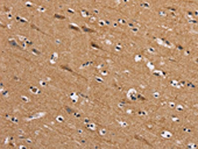 The image on the left is immunohistochemistry of paraffin-embedded Human brain  tissue using AAAS Antibody(AAAS Antibody) at dilution 1/20, on the right is treated with fusion protein. (Original magnification: ×200)