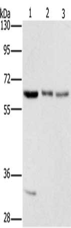Gel: 8%SDS-PAGE, Lysate: 40 μg, Lane 1-3: 293T cells, hela cells, PC3 cells, Primary antibody: AAAS Antibody(AAAS Antibody) at dilution 1/400, Secondary antibody: Goat anti rabbit IgG at 1/8000 dilution, Exposure time: 10 seconds