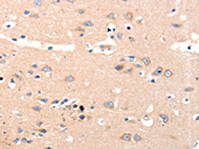 The image on the left is immunohistochemistry of paraffin-embedded Human brain tissue using the antibody Antibody) at dilution 1/12, on the right is treated with synthetic peptide. (Original magnification: ×200)Rabbit anti-Human OLR1 Polyclonal Antibody
