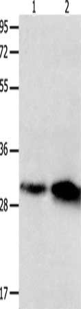 Gel: 12%SDS-PAGE, Lysate: 40 μg, Lane 1-2: Mouse brain tissue, Mouse lung tissue, Primary antibody: OLR1 Antibody(OLR1 Antibody) at dilution 1/250, Secondary antibody: Goat anti rabbit IgG at 1/8000 dilution, Exposure time: 30 secondsRabbit anti-Human OLR1 Polyclonal Antibody