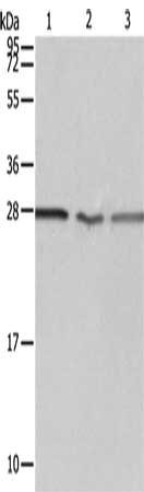 Gel: 12%SDS-PAGE, Lysate: 40 μg, Lane 1-3: Jurkat cells, A549 cells, Human fetal kidney tissue, Primary antibody: PSMD9 Antibody(PSMD9 Antibody) at dilution 1/750, Secondary antibody: Goat anti rabbit IgG at 1/8000 dilution, Exposure time: 10 secondsRabbit anti-Human PSMD9 Polyclonal Antibody