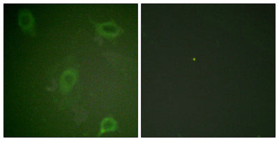 Immunofluorescence staining of methanol-fixed HeLa cells using Amyloid β A4 (phospho-Thr743/668) Antibody.Rabbit anti-Human APP Polyclonal Antibody