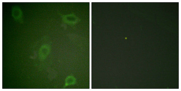 Immunofluorescence staining of methanol-fixed HeLa cells using Amyloid β A4 (phospho-Thr743/668) Antibody.Rabbit anti-Human APP Polyclonal Antibody