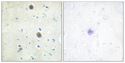 Immunohistochemical analysis of paraffin-embedded human brain tissue using Amyloid β A4 (phospho-Thr743/668) antibody (left)or the same antibody preincubated with blocking peptide (right).Rabbit anti-Human APP Polyclonal Antibody