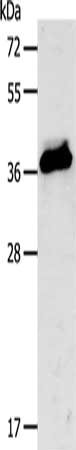 Gel: 10%SDS-PAGE, Lysate: 40 μg, Lane: Mouse liver tissue, Primary antibody: CXCR3 Antibody(CXCR3 Antibody) at dilution 1/250, Secondary antibody: Goat anti rabbit IgG at 1/8000 dilution, Exposure time: 40 secondsRabbit anti-Human CXCR3 Polyclonal Antibody