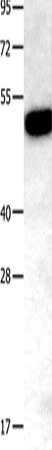 Gel: 10%SDS-PAGE, Lysate: 40 μg, Lane: Mouse kidney tissue, Primary antibody: TNFRSF11B Antibody(TNFRSF11B Antibody) at dilution 1/400, Secondary antibody: Goat anti rabbit IgG at 1/8000 dilution, Exposure time: 2 minutesRabbit anti-Human TNFRSF11B Polyclonal Antibody
