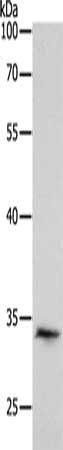 Gel: 10%SDS-PAGE, Lysate: 40 μg, Lane: Hela cells, Primary antibody: RCHY1 Antibody(RCHY1 Antibody) at dilution 1/300, Secondary antibody: Goat anti rabbit IgG at 1/8000 dilution, Exposure time: 2 minutesRabbit anti-Human RCHY1 Polyclonal Antibody