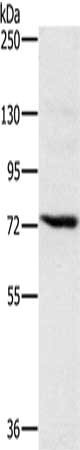 Gel: 6%SDS-PAGE, Lysate: 40 μg, Lane: Jurkat cells, Primary antibody: NCSTN Antibody(NCSTN Antibody) at dilution 1/500, Secondary antibody: Goat anti rabbit IgG at 1/8000 dilution, Exposure time: 1 minuteRabbit anti-Human NCSTN Polyclonal Antibody