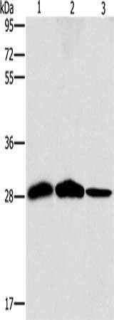 Gel: 10%SDS-PAGE, Lysate: 40 μg, Lane 1-3: Mouse liver tissue, human chromaffin cell tumor tissue, hepG2 cells, Primary antibody: SPR Antibody(SPR Antibody) at dilution 1/1500, Secondary antibody: Goat anti rabbit IgG at 1/8000 dilution, Exposure time: 10 secondsRabbit anti-Human SPR Polyclonal Antibody