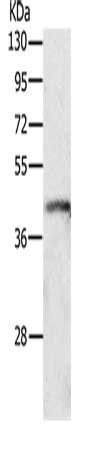 Gel: 10%SDS-PAGE, Lysate: 40 μg, Lane: K562 cells, Primary antibody: P2RY4 Antibody(P2RY4 Antibody) at dilution 1/500, Secondary antibody: Goat anti rabbit IgG at 1/8000 dilution, Exposure time: 1 minuteRabbit anti-Human P2RY4 Polyclonal Antibody