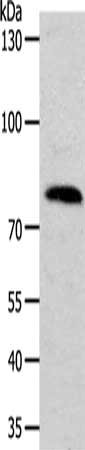 Gel: 10%SDS-PAGE, Lysate: 50 μg, Lane: Hela cells, Primary antibody: ADAM11 Antibody(ADAM11 Antibody) at dilution 1/200, Secondary antibody: Goat anti rabbit IgG at 1/8000 dilution, Exposure time: 10 minutesRabbit anti-Human ADAM11 Polyclonal Antibody