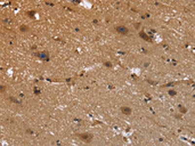 The image is immunohistochemistry of paraffin-embedded Human brain  tissue using FRK Antibody(FRK Antibody) at dilution 1/40. (Original magnification: ×200)Rabbit anti-Human FRK Polyclonal Antibody