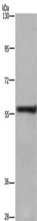 Gel: 6%SDS-PAGE, Lysate: 40 μg, Lane: A431 cells, Primary antibody: FRK Antibody(FRK Antibody) at dilution 1/1000, Secondary antibody: Goat anti rabbit IgG at 1/8000 dilution, Exposure time: 5 minutesRabbit anti-Human FRK Polyclonal Antibody