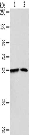 Gel: 10%SDS-PAGE, Lysate: 40 μg, Lane 1-2: A375 cells, mouse liver tissue, Primary antibody: NAMPT Antibody(NAMPT Antibody) at dilution 1/350, Secondary antibody: Goat anti rabbit IgG at 1/8000 dilution, Exposure time: 2 minutesRabbit anti-Human NAMPT Polyclonal Antibody