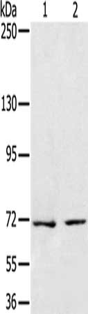 Gel: 6%SDS-PAGE, Lysate: 40 μg, Lane 1-2: Jurkat cells, Raji cells, Primary antibody: SENP1 Antibody(SENP1 Antibody) at dilution 1/200, Secondary antibody: Goat anti rabbit IgG at 1/8000 dilution, Exposure time: 1 minuteRabbit anti-Human SENP1 Polyclonal Antibody