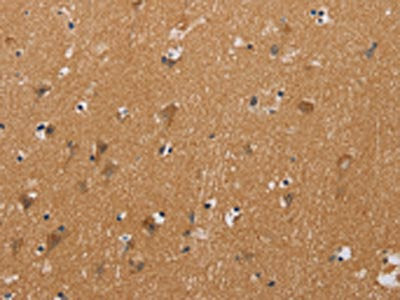 The image on the left is immunohistochemistry of paraffin-embedded Human brain  tissue using CHRNA4 Antibody(CHRNA4 Antibody) at dilution 1/20, on the right is treated with fusion protein. (Original magnification: ×200)Rabbit anti-Human CHRNA4 Polyclonal Antibody