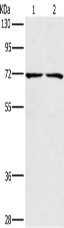 Gel: 8%SDS-PAGE, Lysate: 40 μg, Lane 1-2: Lovo cells, 293T cells, Primary antibody: CHRNA4 Antibody(CHRNA4 Antibody) at dilution 1/200, Secondary antibody: Goat anti rabbit IgG at 1/8000 dilution, Exposure time: 5 secondsRabbit anti-Human CHRNA4 Polyclonal Antibody