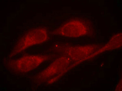 Immunofluorescence staining of methanol-fixed Hela cells using Shc1(Phospho-Tyr427) Antibody.Rabbit anti-Human SHC1 Polyclonal Antibody