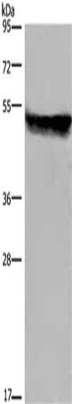 Gel: 8%SDS-PAGE, Lysate: 40 μg, Lane: Mouse liver tissue, Primary antibody: CYP2E1 Antibody(CYP2E1 Antibody) at dilution 1/250, Secondary antibody: Goat anti rabbit IgG at 1/8000 dilution, Exposure time: 10 secondsRabbit anti-Human CYP2E1 Polyclonal Antibody
