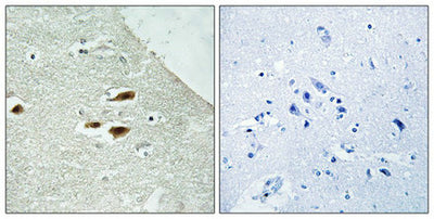 Immunohistochemistry analysis of paraffin-embedded human brain tissue using Period Circadian Protein 2 (Phospho-Ser662) antibody. The picture on the right is treated with the synthesized peptide.Rabbit anti-Human PER2 Polyclonal Antibody