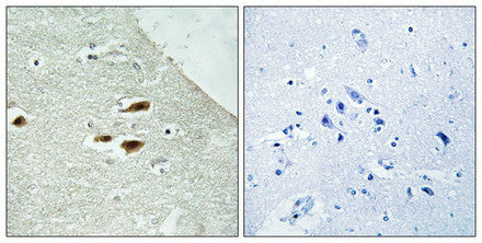 Immunohistochemistry analysis of paraffin-embedded human brain tissue using Period Circadian Protein 2 (Phospho-Ser662) antibody. The picture on the right is treated with the synthesized peptide.Rabbit anti-Human PER2 Polyclonal Antibody