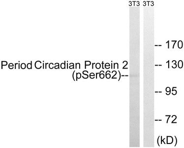Western blot analysis of extracts from 3T3 cells, treated with PMA (125ng/ml, 30mins), using Period Circadian Protein 2 (Phospho-Ser662) antibody. The lane on the right is treated with the synthesized peptide.Rabbit anti-Human PER2 Polyclonal Antibody