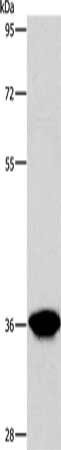 Gel: 8%SDS-PAGE, Lysate: 80 μg, Lane: Human liver cancer tissue, Primary antibody: AKR1D1 Antibody(AKR1D1 Antibody) at dilution 1/650, Secondary antibody: Goat anti rabbit IgG at 1/8000 dilution, Exposure time: 1 minuteRabbit anti-Human AKR1D1 Polyclonal Antibody