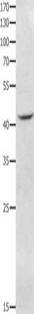 Gel: 10+12%SDS-PAGE, Lysate: 40 μg, Lane: RAW264.7 cells, Primary antibody: NFKBID Antibody(NFKBID Antibody) at dilution 1/650, Secondary antibody: Goat anti rabbit IgG at 1/8000 dilution, Exposure time: 2 minutesRabbit anti-Human NFKBID Polyclonal Antibody