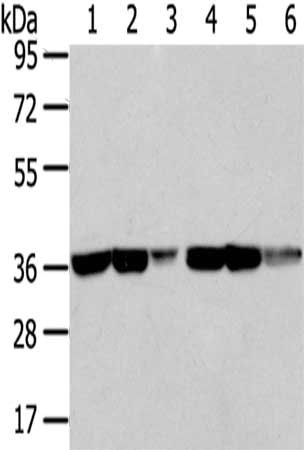 Gel: 8%SDS-PAGE,Lysate: 40 μg,Lane 1-6: Mouse kidney tissue, Human kidney tissue, Mouse brain tissue, A431 cells, Human placenta tissue, Human fetal brain tissue,Primary antibody: TALDO1 Antibody(TALDO1 Antibody) at dilution 1/400 dilution,Secondary antibody: Goat anti rabbit IgG at 1/8000 dilution,Exposure time: 10 secondsRabbit anti-Human TALDO1 Polyclonal Antibody