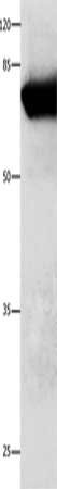Gel: 10%SDS-PAGE, Lysate: 30 μg, Lane: Mouse kidney tissue, Primary antibody: ANXA6 Antibody(ANXA6 Antibody) at dilution 1/350, Secondary antibody: Goat anti rabbit IgG at 1/8000 dilution, Exposure time: 10 secondsRabbit anti-Human ANXA6 Polyclonal Antibody
