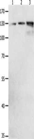 Gel: 8%SDS-PAGE, Lysate: 40μg, Lane 1-3: Human brain malignant glioma tissue, Human colon cancer tissue, mouse pancreas tissue, Primary antibody: CDH1 Antibody(CDH1 Antibody) at dilution 1/1950, Secondary antibody: Goat anti rabbit IgG at 1/8000 dilution, Exposure time: 3 secondsRabbit anti-Human CDH1 Polyclonal Antibody