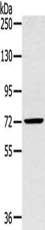 Gel: 6%SDS-PAGE, Lysate: 40 μg, Lane: Mouse liver tissue, Primary antibody: SLC27A5 Antibody(SLC27A5 Antibody) at dilution 1/250, Secondary antibody: Goat anti rabbit IgG at 1/8000 dilution, Exposure time: 2 minutesRabbit anti-Human SLC27A5 Polyclonal Antibody
