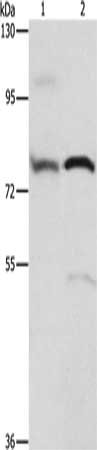 Gel: 6%SDS-PAGE, Lysate: 40 μg, Lane 1-2: 293T cells, human fetal brain tissue, Primary antibody: ATXN1 Antibody(ATXN1 Antibody) at dilution 1/800, Secondary antibody: Goat anti rabbit IgG at 1/8000 dilution, Exposure time: 20 seconds