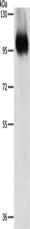 Gel: 8%SDS-PAGE, Lysate: 40 μg, Lane: Jurkat cells, Primary antibody: ITGB3 Antibody(ITGB3 Antibody) at dilution 1/450, Secondary antibody: Goat anti rabbit IgG at 1/8000 dilution, Exposure time: 10 seconds