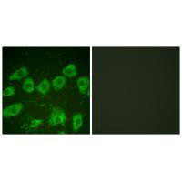 Immunofluorescence analysis of HuvEc cells, using Tyrosine Hydroxylase (Ab-19) antibody.Rabbit anti-Human TH Polyclonal Antibody