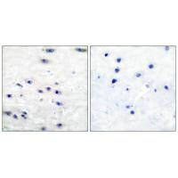 Immunohistochemical analysis of paraffin-embedded human brain tissue using Tyrosine Hydroxylase (Ab-19) antibody.Rabbit anti-Human TH Polyclonal Antibody