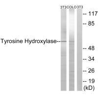 Western blot analysis of extracts from 3T3 cells treated with Forskolin (40nM, 30min), using Tyrosine Hydroxylase (Ab-19) antibody.Rabbit anti-Human TH Polyclonal Antibody
